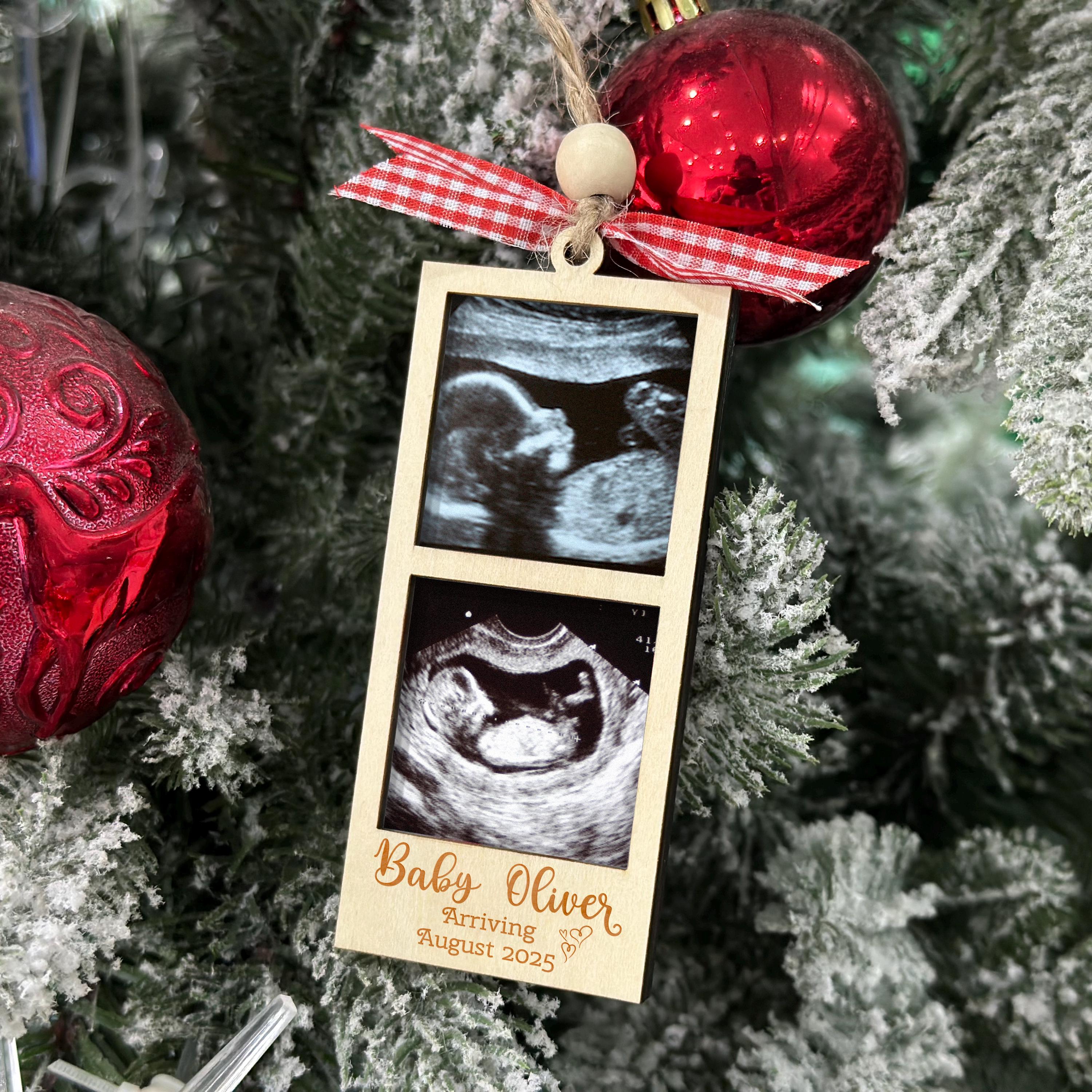 Ultrasound Ornament Frame Canada