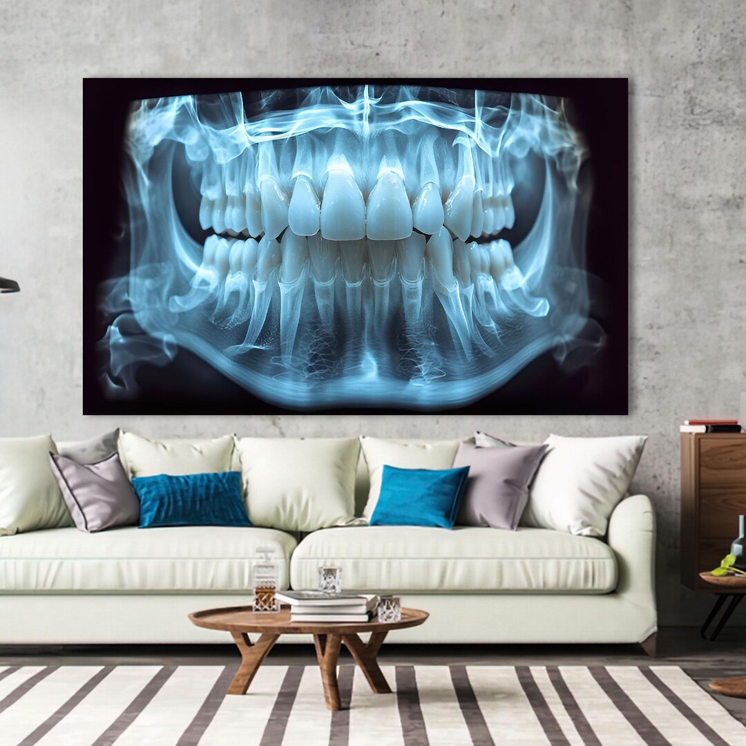 Dental X-ray Canvas Wall Art - Panoramic Jaw Radiograph Poster - Modern ...