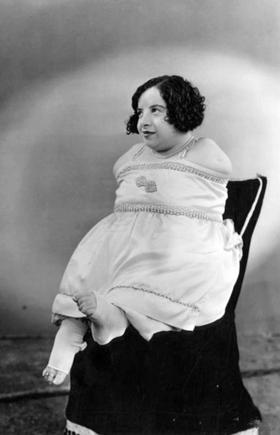 9XP0223 – Bizarre Victorian Era Human Oddities Circus Freaks
