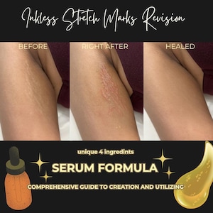 May include: Image showing a before-and-after comparison of stretch marks, with the text "Inkless Stretch Marks Revision." The image includes a serum bottle and the words "SERUM FORMULA" and "COMPREHENSIVE GUIDE TO CREATION AND UTILIZING."