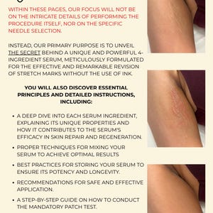May include: A guide titled "Welcome" on creating and using a serum for inkless stretch mark revision. The page includes text and images of skin with stretch marks. It details serum ingredients, mixing techniques, storage, application, and aftercare.