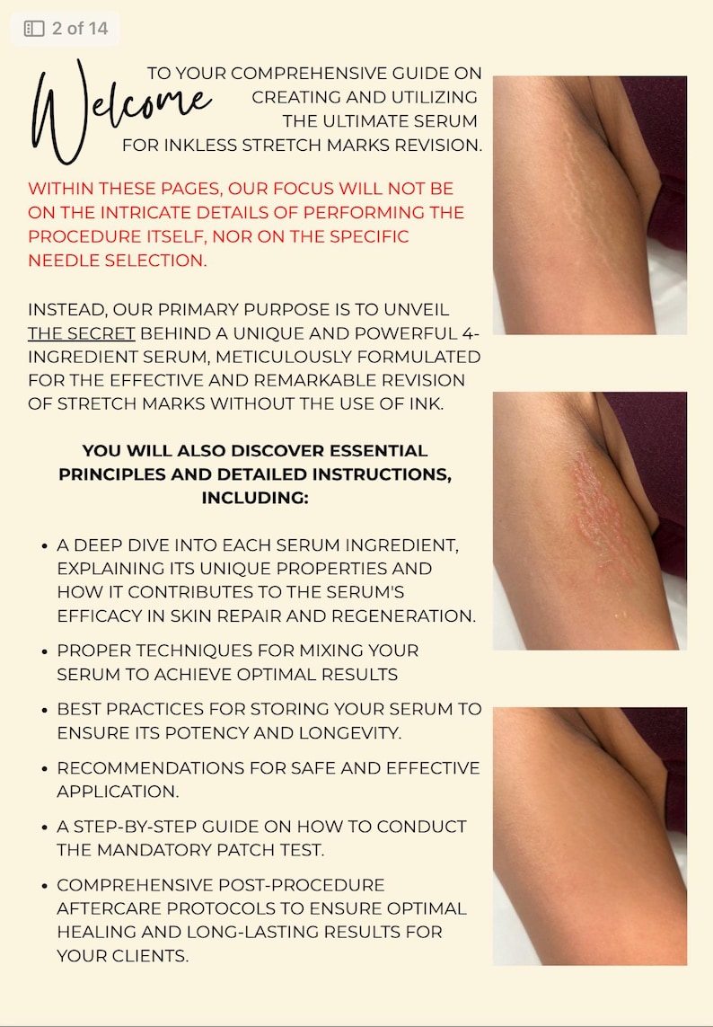 May include: A guide titled "Welcome" on creating and using a serum for inkless stretch mark revision. The page includes text and images of skin with stretch marks. It details serum ingredients, mixing techniques, storage, application, and aftercare.
