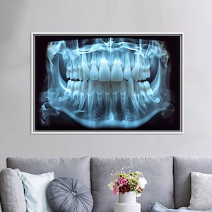 Dental X-Ray Canvas Wall Art, Modern Medical Tooth Poster, Dentist Office Decor, Blue Skull Teeth Print for Clinic or Dental School Gift