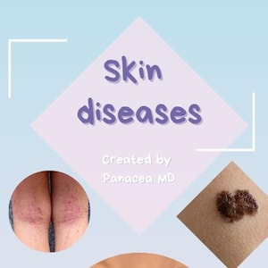 May include: A graphic illustrating various skin diseases. The image features three close-up photographs of skin conditions. The first photo shows a person's knees with red, bumpy skin. The second photo shows a person's arm with a dark brown mole. The third photo shows a person's hands with patches of white skin. The text "Skin diseases" is written in purple letters on a pink background. The text "Created by Panacea MD" is written in black letters on a pink background.