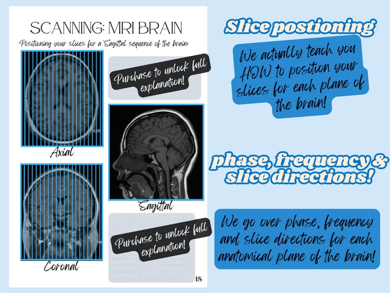 Mri Text MRI Scanning Guide: How to Scan the BRAIN in MRI (pdf Download) - Etsy ...