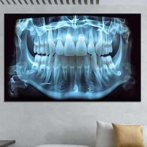 Dental X-Ray Art Canvas Poster, Anatomical Teeth Radiograph Wall Print on Cotton Canvas, Modern Medical Decor for Clinic, Office or Studio