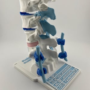 Lumbar Spine Model to Demonstrate Procedures, detachable vertebra