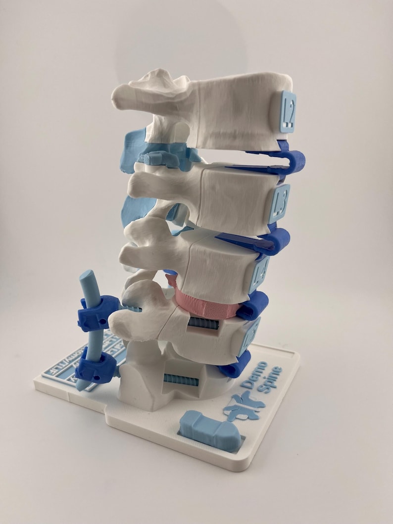 Lumbar Spine Model to Demonstrate Procedures, Detachable Vertebra - Etsy