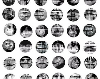 dental xray pictures collage sheet 1 inch circles clipart digital downloadable teeth xrays printable images bottlecaps pendants bezels