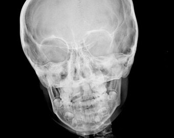 human skull x ray photo, digital print, instant download, xray images, medical, skeleton, human anatomy printables