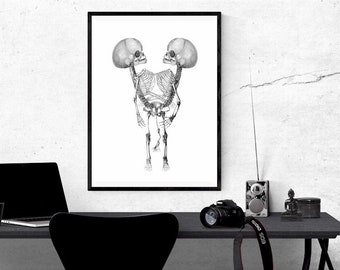 conjoined siamese twins png, skeletons png human oddities printable wall art, child anatomy clipart, jpg digital instant download