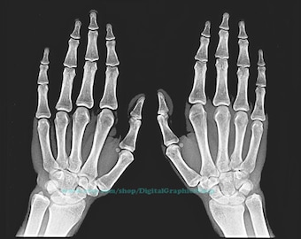 human skeleton hands x ray photo, digital print, instant download, xray images, medical, skeleton, human anatomy printables