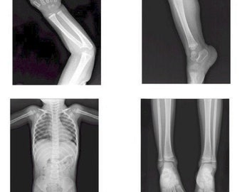 xray printable etsy