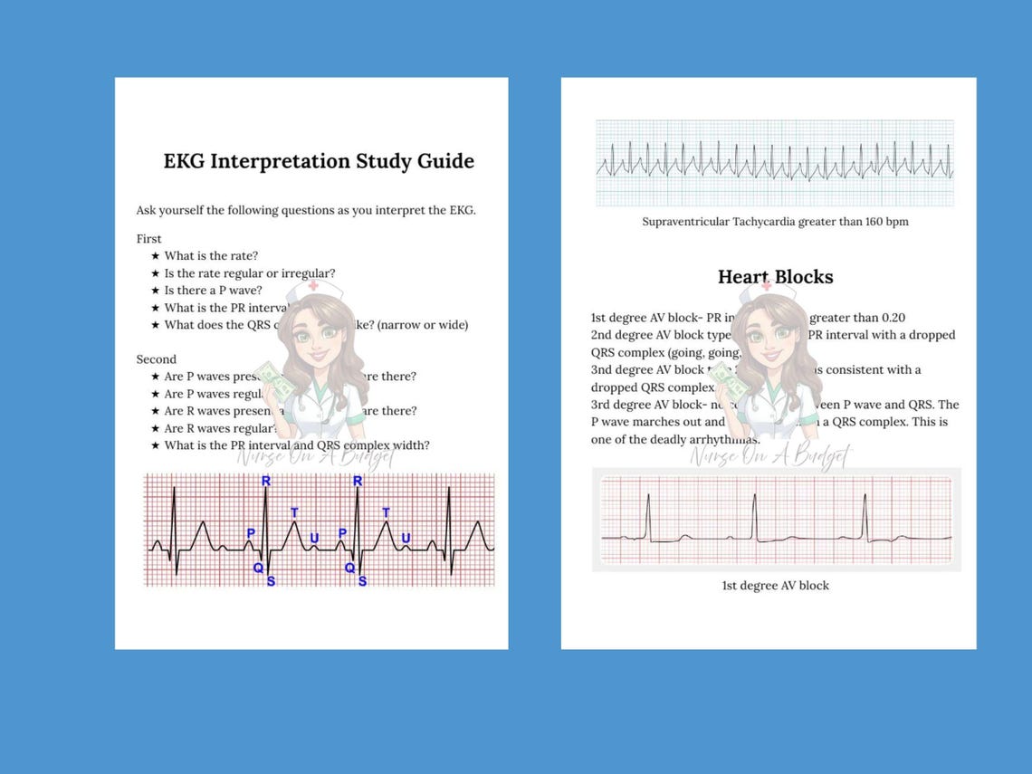EKG Interpretation Study Guide With Practice Strips - Etsy