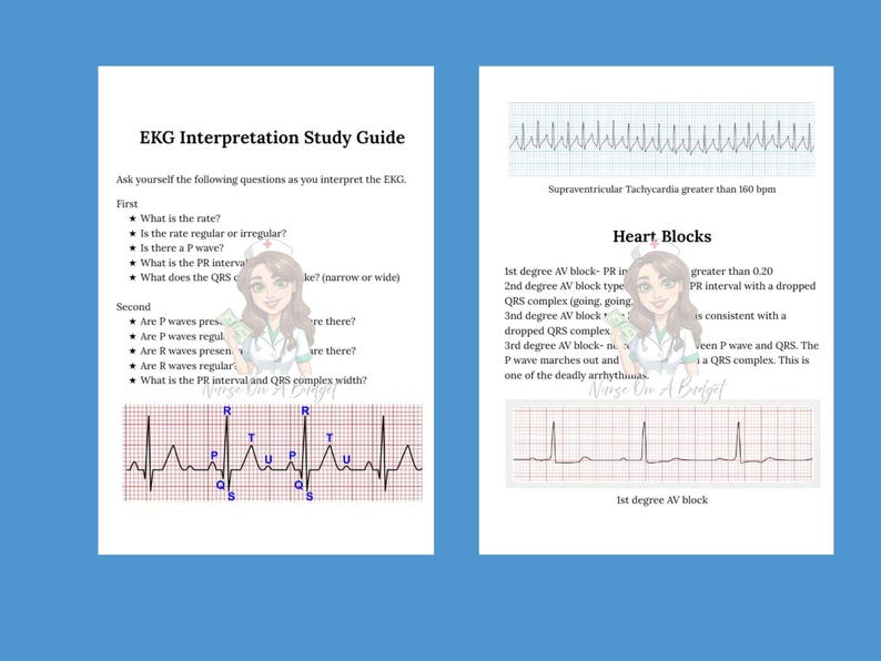 EKG Interpretation Study Guide With Practice Strips - Etsy