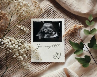 Op de afbeelding: Een zwart-witte echografie van een baby in de baarmoeder, met de tekst "Januari 2025" en twee getekende harten onder de afbeelding.