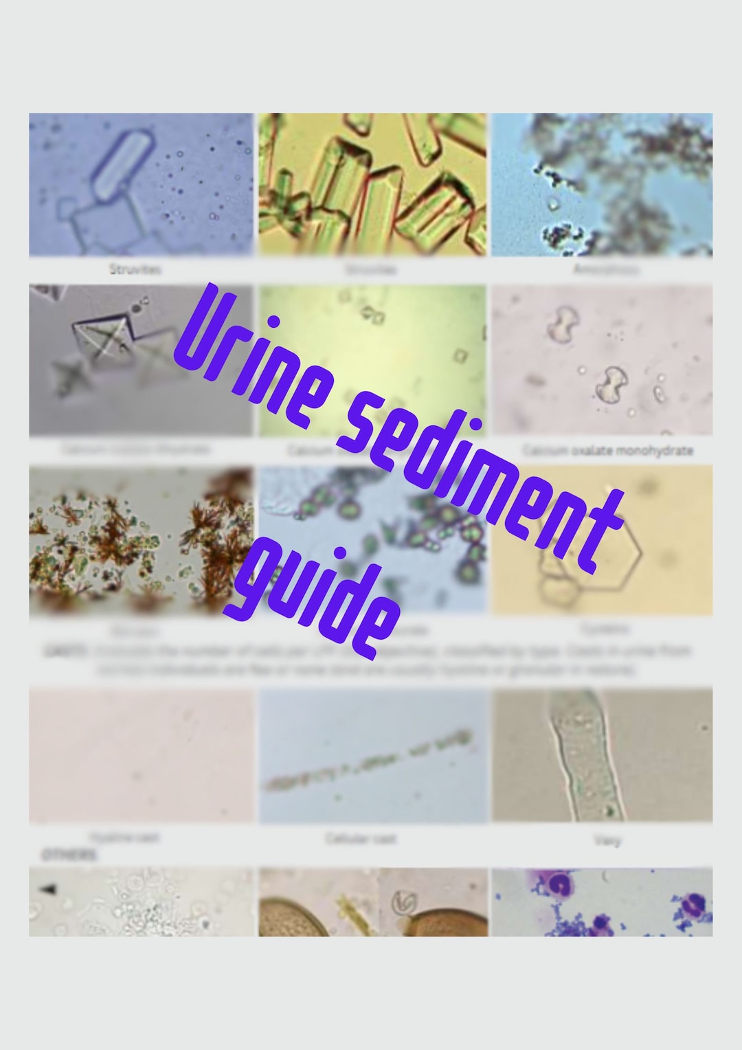 Urine Sediment Guide Etsy