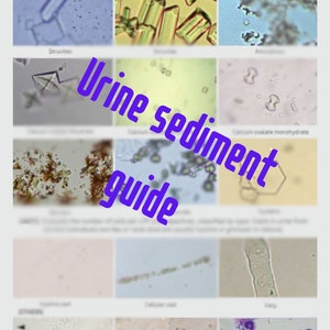 Może przedstawiać: Wykres z mikroskopowymi obrazami osadu moczu, opisanymi nazwami takimi jak "Struvite", "Jednowodzian szczawianu wapnia" i "Odlew", z tekstem "Przewodnik po osadzie moczu" w kolorze fioletowym.