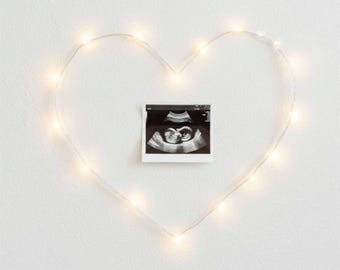 Pregnancy Announcement Digital: Ultrasound Baby Reveal Template Download
