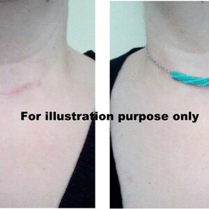 Thyroid scar necklace Clearance
