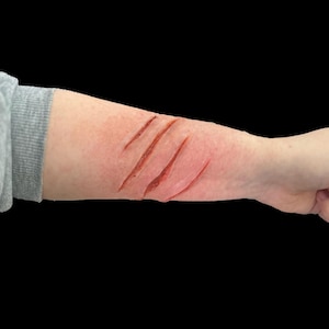 Pode incluir: Um close-up de um braço com quatro lacerações simuladas, que parecem cortes vermelhos profundos. A pele ao redor das feridas é avermelhada, em um fundo preto. A pessoa está vestindo uma camisa cinza de manga comprida.