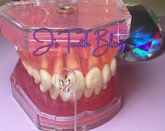 Tooth Gem Size Guide Sticks - 25 count