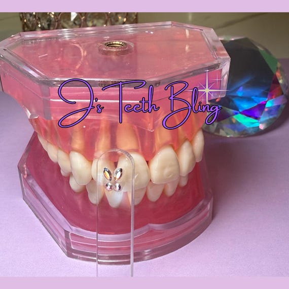 Tooth Gem Size Guide Sticks - 25 count