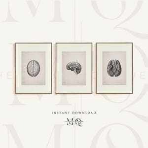Puede incluir: Tres ilustraciones anatómicas en blanco y negro del cerebro humano en impresiones enmarcadas. Las impresiones están sobre un fondo blanco.