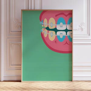 Teeth Braces for Dental Clinic, Dentist Quirky Office Poster, Orthodontic Brace Funny Art, Orthodontist Sign for Wall, Dentistry Home Decor