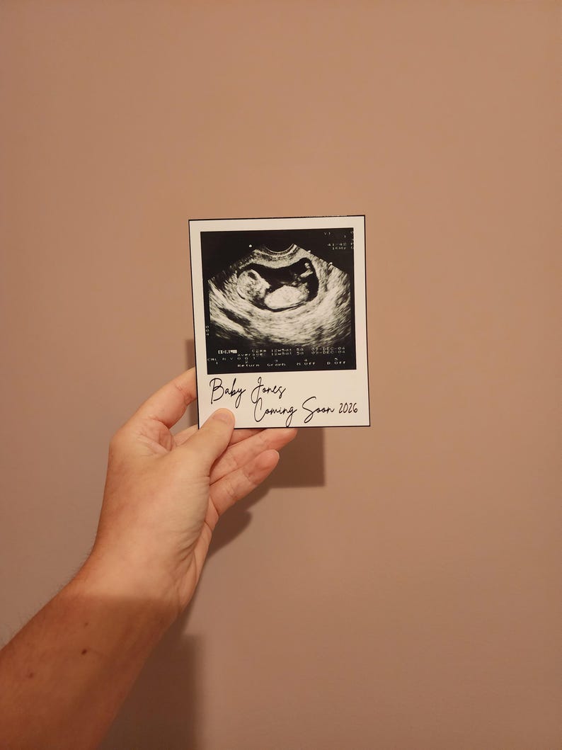 Sonogram Magnets Ultrasound Magnet, Custom Photo Magnet, Baby Announcement Magnet ...