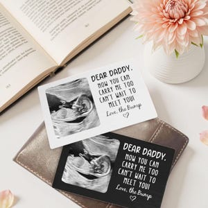 Aangepaste portemonnee voor baby-echografie. Cadeau nieuwe baby-echo. Cadeaus voor aanstaande vaders. Cadeaus herdenkingsmonument baby-echografie. Cadeaus voor vaderdag