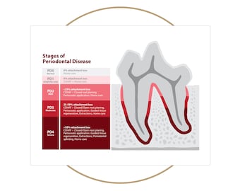 Veterinary Stages of Periodontal Disease Poster (Red) - 8.5 x 11 in and 18 x 24 in | Printable Digital Download