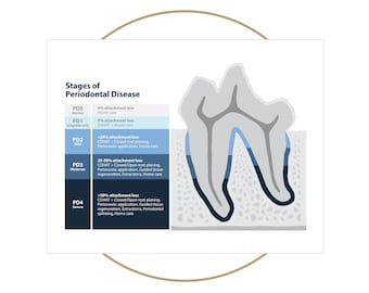Veterinary Stages of Periodontal Disease Poster (Blue) - 8.5 x 11 in and 18 x 24 in | Printable Digital Download