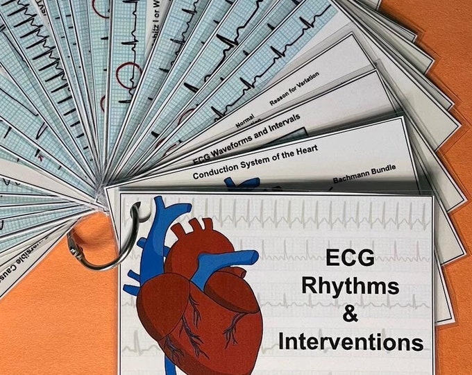 ECG Rhythms and Interventions Flashcards for Nurses, Nursing Students ...