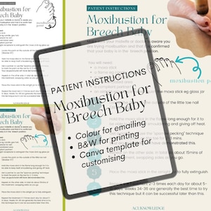 Moxibustion for Breech Baby - a handout for your clients
