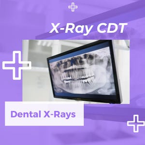 May include: A close-up of a dental x-ray image displayed on a computer monitor in a dental office. The image shows a person's teeth and jaw. The text "X-Ray CDT" is displayed above the monitor. The text "Dental X-Rays" is displayed below the monitor.