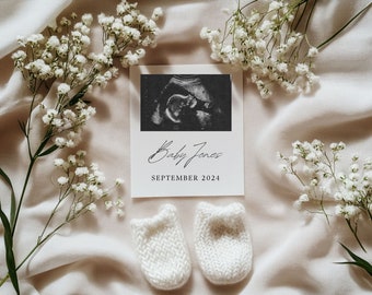 Puede incluir: Una tarjeta blanca con una imagen de ultrasonido en blanco y negro y el texto "Baby Jones" y "SEPTEMBER 2024". La tarjeta está rodeada de zapatitos de bebé blancos y flores blancas.