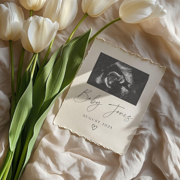 Modelo simples de anúncio de gravidez neutro Anúncio digital de bebê Revelação de gravidez em mídia social Modelo simples de gravidez editável