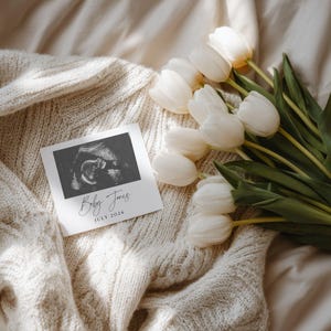 Simple Neutral Ultrasound Pregnancy Announcement Template | Digital Baby Reveal with White Tulips | Editable Social Media Pregnancy Reveal