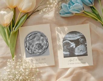 IVF Pregnancy Announcement Template Printable, IVF Baby Reveal, IVF Social Media Template, Pregnancy Reveal Template for Social Media
