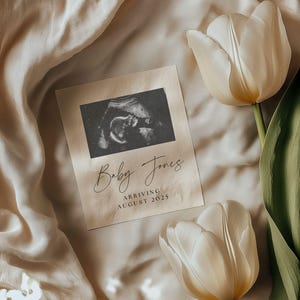 Neutral Tulip Pregnancy Announcement Template Digital Baby Announcement Social Media Pregnancy Reveal Editable Simple Pregnancy Template
