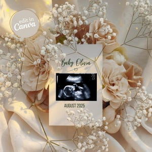 Simple Minimalist Floral Baby Announcement, Digital Modern Pregnancy Announce, Neutral Gender Reveal Social Media Template, Aesthetic Flower