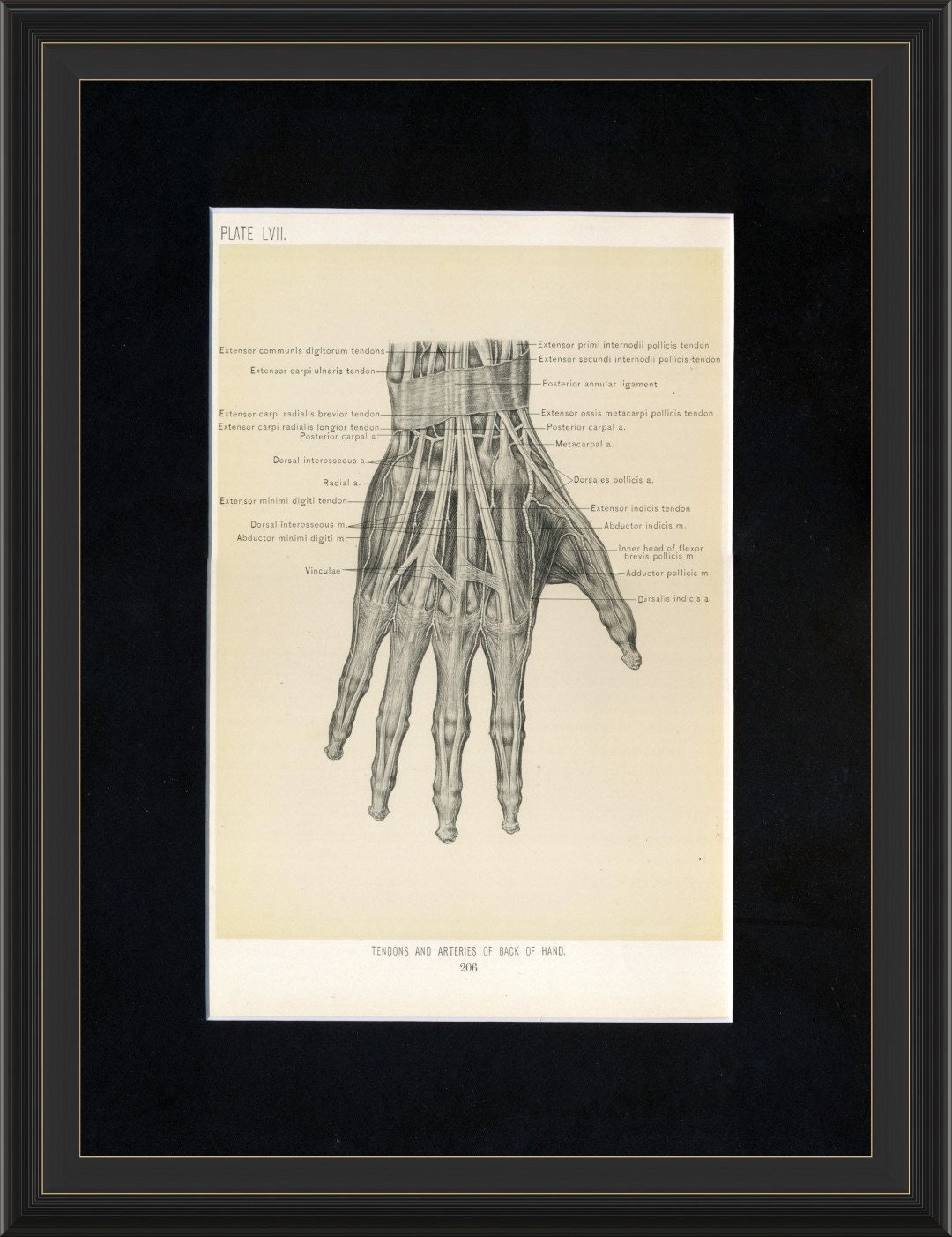 1899 Anatomy Print – Hand Tendons and Arteries, Matted Medical Art - Etsy