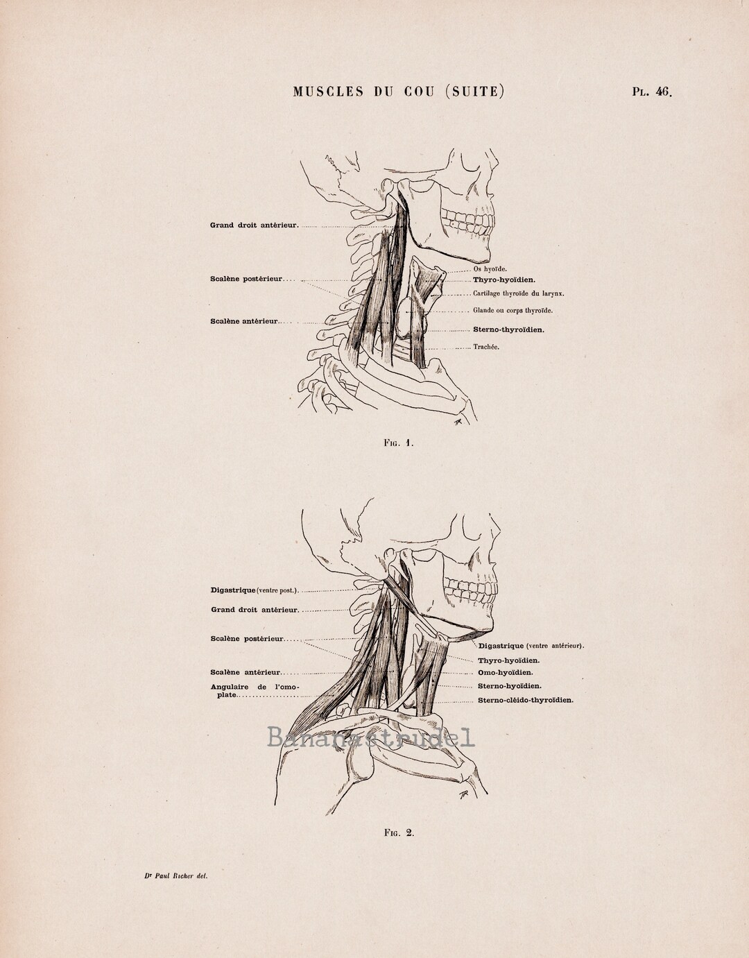 Large Antique French Anatomy Print - Muscles of the Neck - Plate 46 ...
