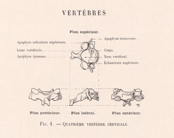 Large Antique French Anatomy Print - Vertebrae - Spine - Published 1890 - Plate 3