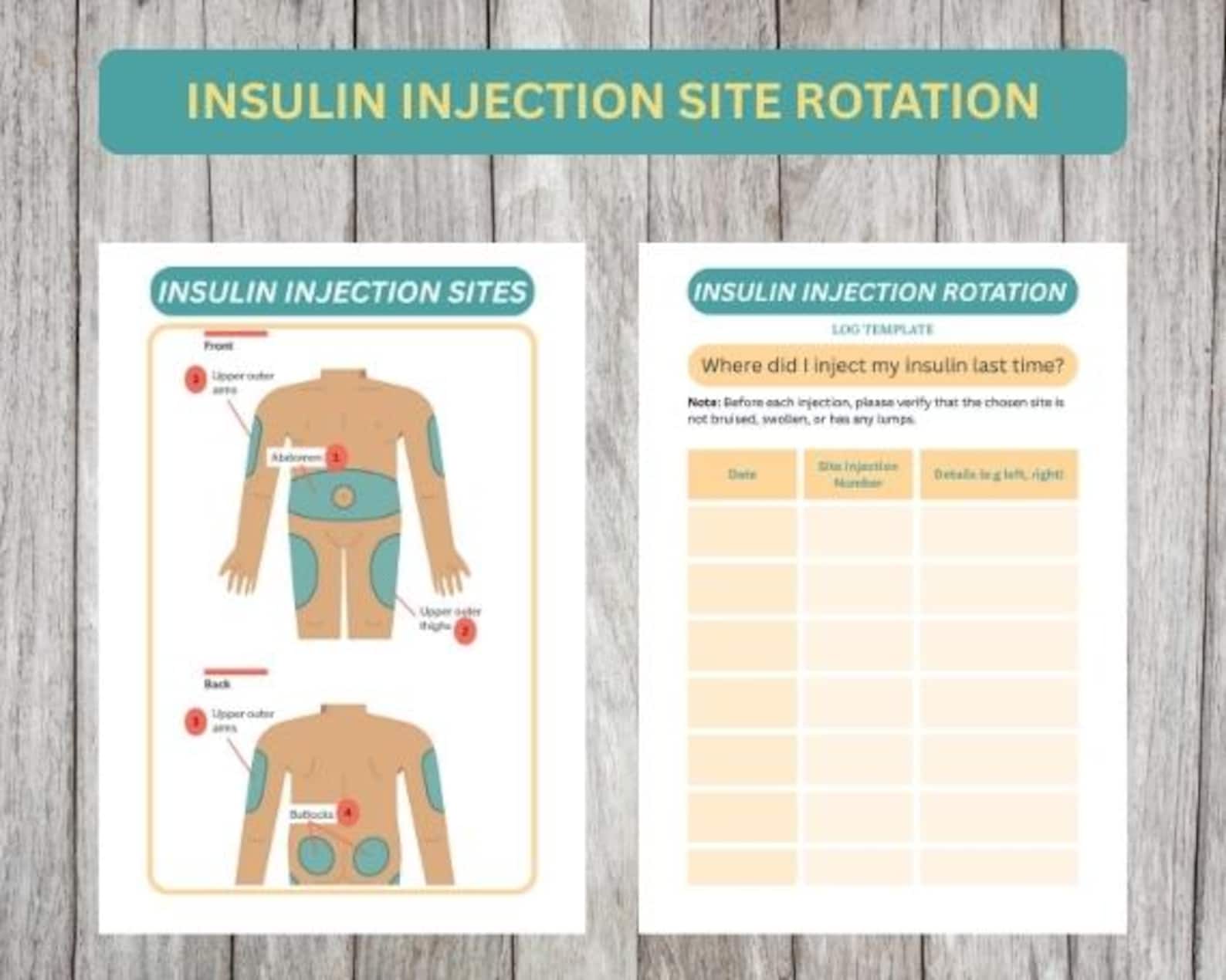 Insulin Rotation Grid Insulin Injection Sites Rotation for Diabetic Patients or Parents of ...