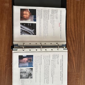 Puede incluir: Dos imágenes de rayos X en blanco y negro de un hombro, que muestran los huesos de la escápula y el húmero. Las imágenes están etiquetadas con términos anatómicos e instrucciones para colocar al paciente para la radiografía.