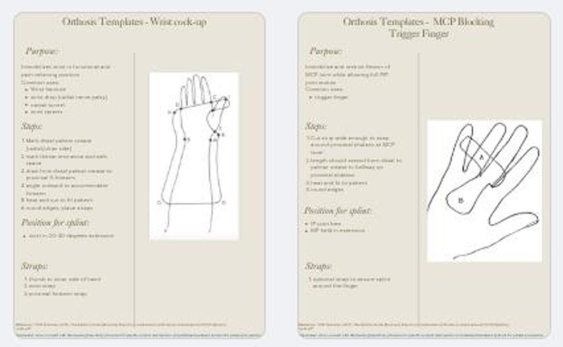Hand Therapy Splint Templates: OT/PT Reference for Splint Types ...