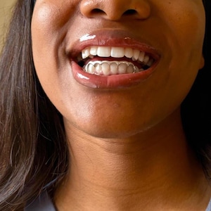 Custom Bottom 6 Set Grillz. Silver, Gold, FREE SHIPPING!