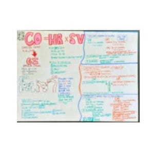 May include: A white board with handwritten notes and diagrams about cardiac output (CO), heart rate (HR), and stroke volume (SV). The equation CO = HR x SV is written in large red letters at the top of the board.